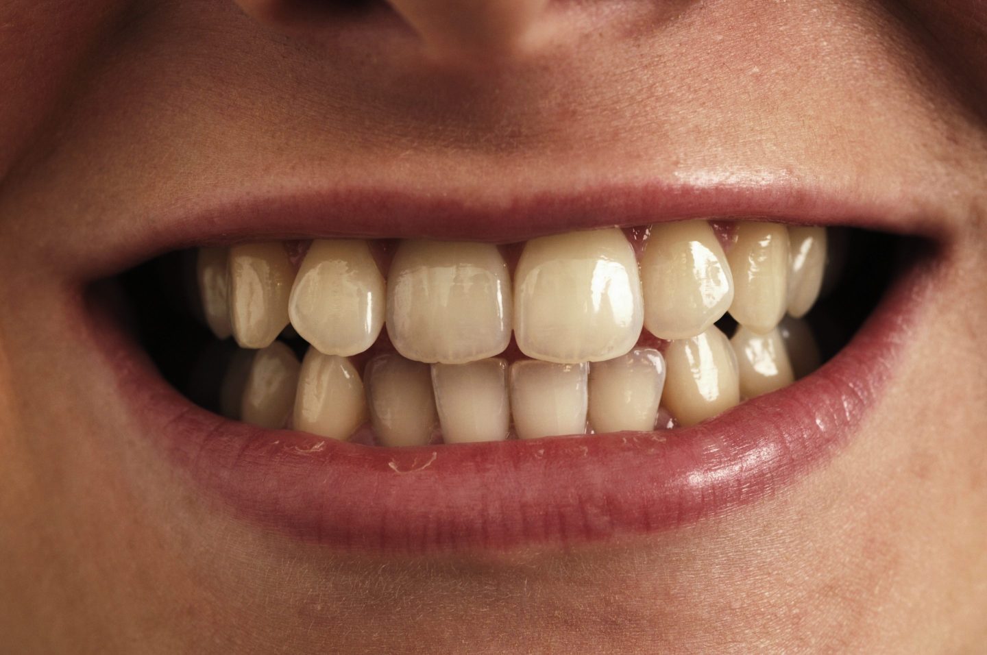 SmileDirect is liquidating.