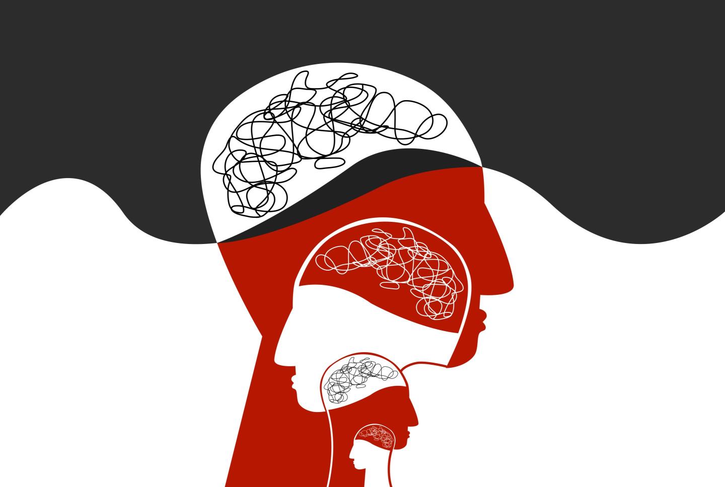 Are Alzheimer’s disease, Parkinson’s disease, and ALS prion diseases? It's a complicated question and one that involves semantics, experts say.