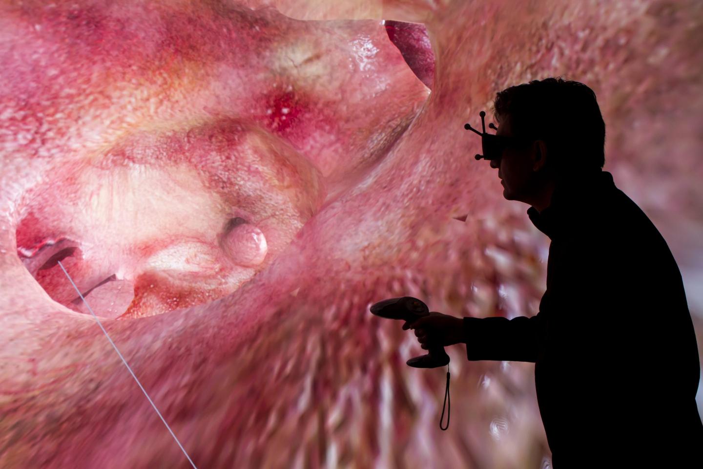 My 2-year-old daughter needed a pacemaker. That spurred me to engineer a virtual heart, and now customized 3D simulations are saving lives