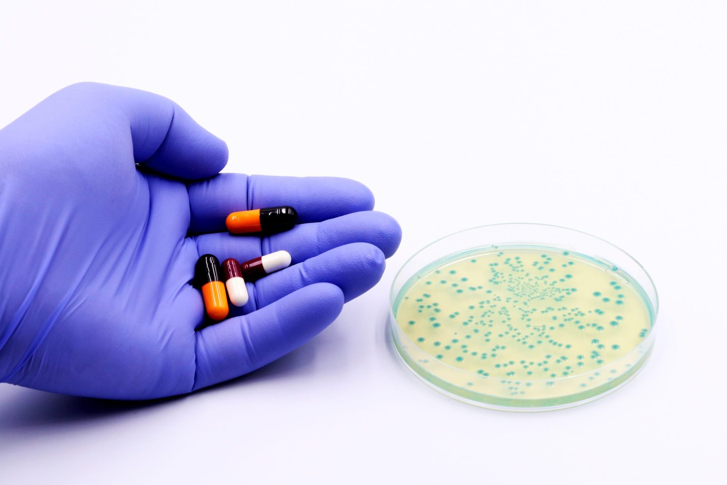 Escherichia coli bacteria grow in a selective microbiological medium inside a Petri dish and in the hand of a doctor or researcher with antibiotics or drugs.