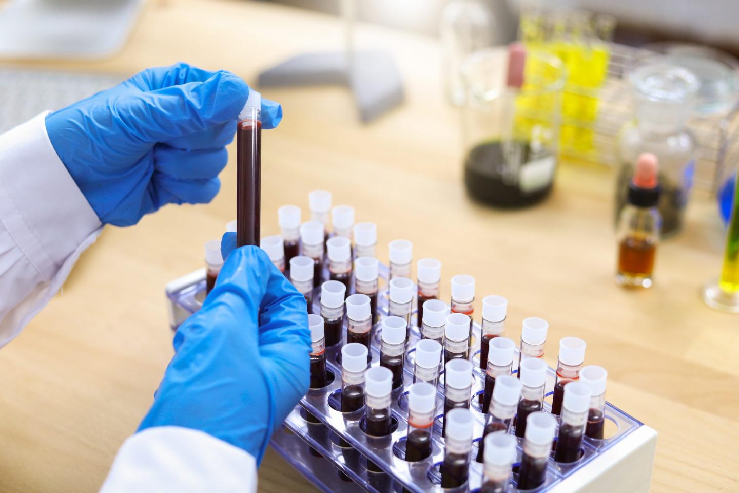 The fallout of the attack has rippled across to primary care providers whose practices rely on the affected hospitals for laboratory services.