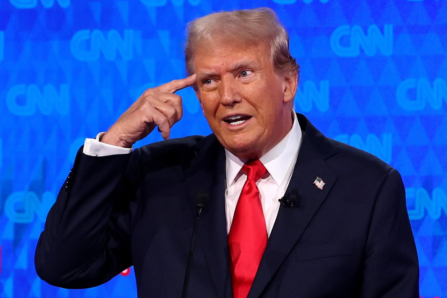 Donald Trump holds finger to his forehead