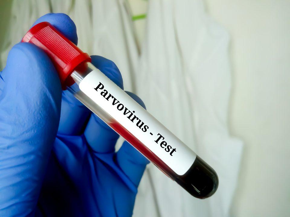 Blood sample for parvovirus test