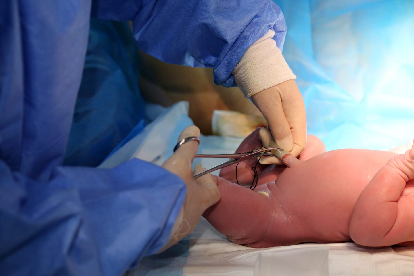 A medical worker cuts the umbilical cord of a newborn ''dragon baby'' at the Maternity and Child Health Hospital in Zaozhuang, Shandong Province, China, on Feb. 10, 2024. China's birth rates fell to a record last year.