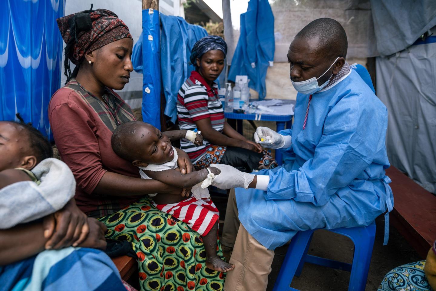 A doctor administers an mpox vaccine in Congo
