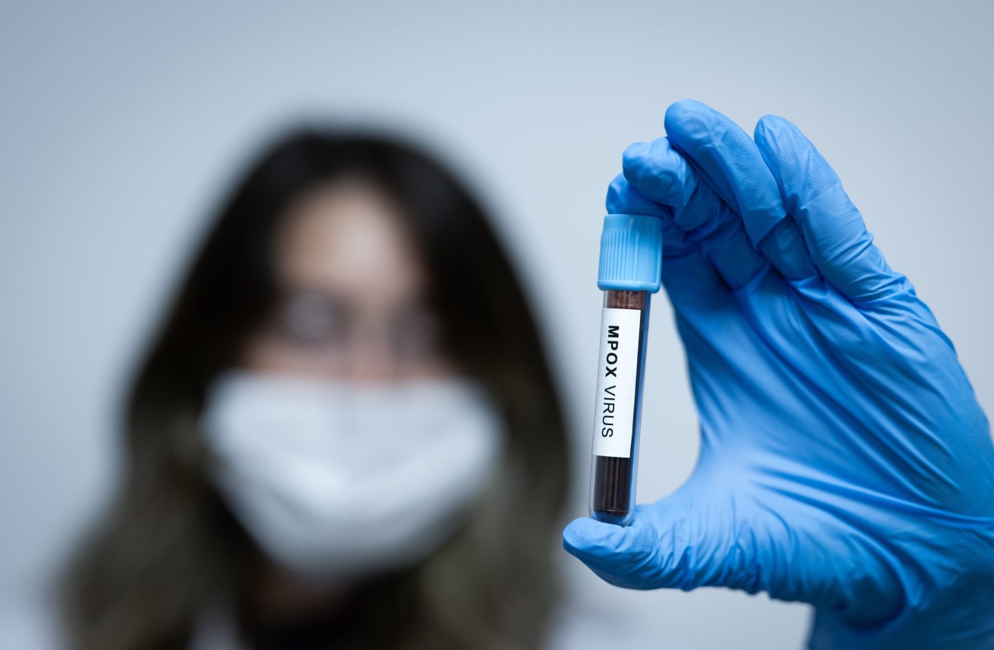 In September, the Pandemic Fund’s board fast-tracked funding to 10 countries to boost their response to mpox.