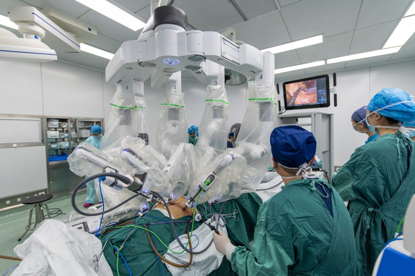 Photo of a Da Vinci surgical robot conducting an operation on a patient's abdomen as several people in surgical garb stand watch nearby.