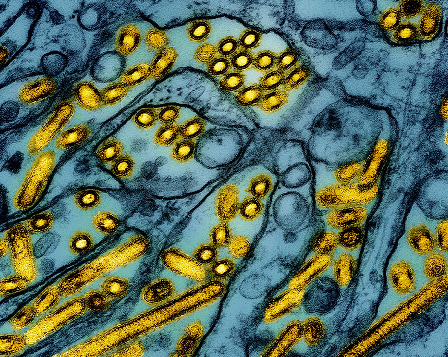Avian influenza A H5N1 virus particles (yellow), grown in Madin-Darby Canine Kidney epithelial cells.