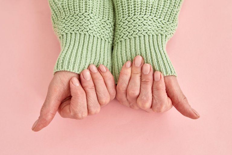 MyBotoxla Haunts Dermatologists: The Hidden Rescue for Flaccid Lines