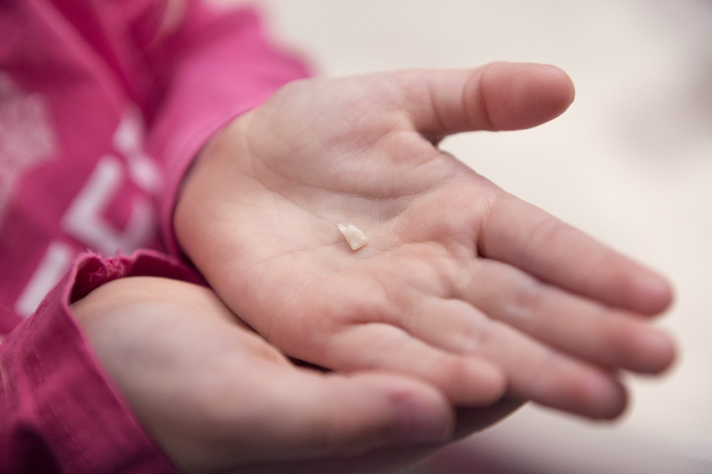 A girl holds a tooth in her hands