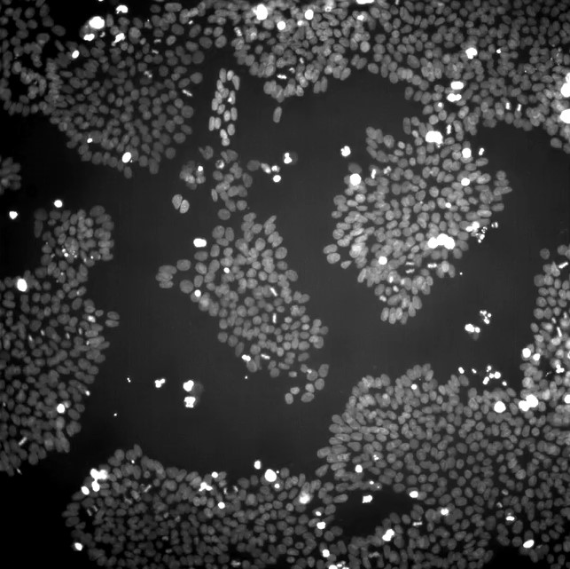 Image of cells under a microscope