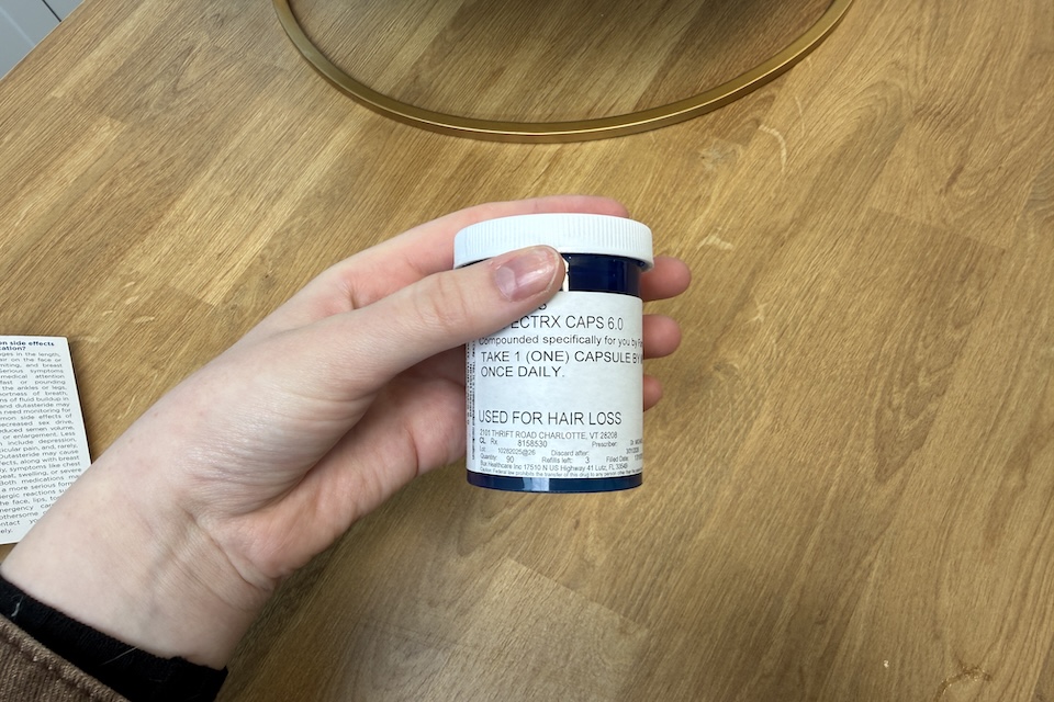 Strut as best hair loss treatment. 