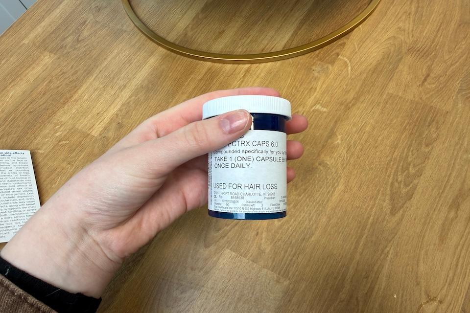Strut as best hair loss treatment.