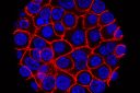 Experimental pill nearly doubles survival time for people with advanced pancreatic cancer. ‘I actually started crying’