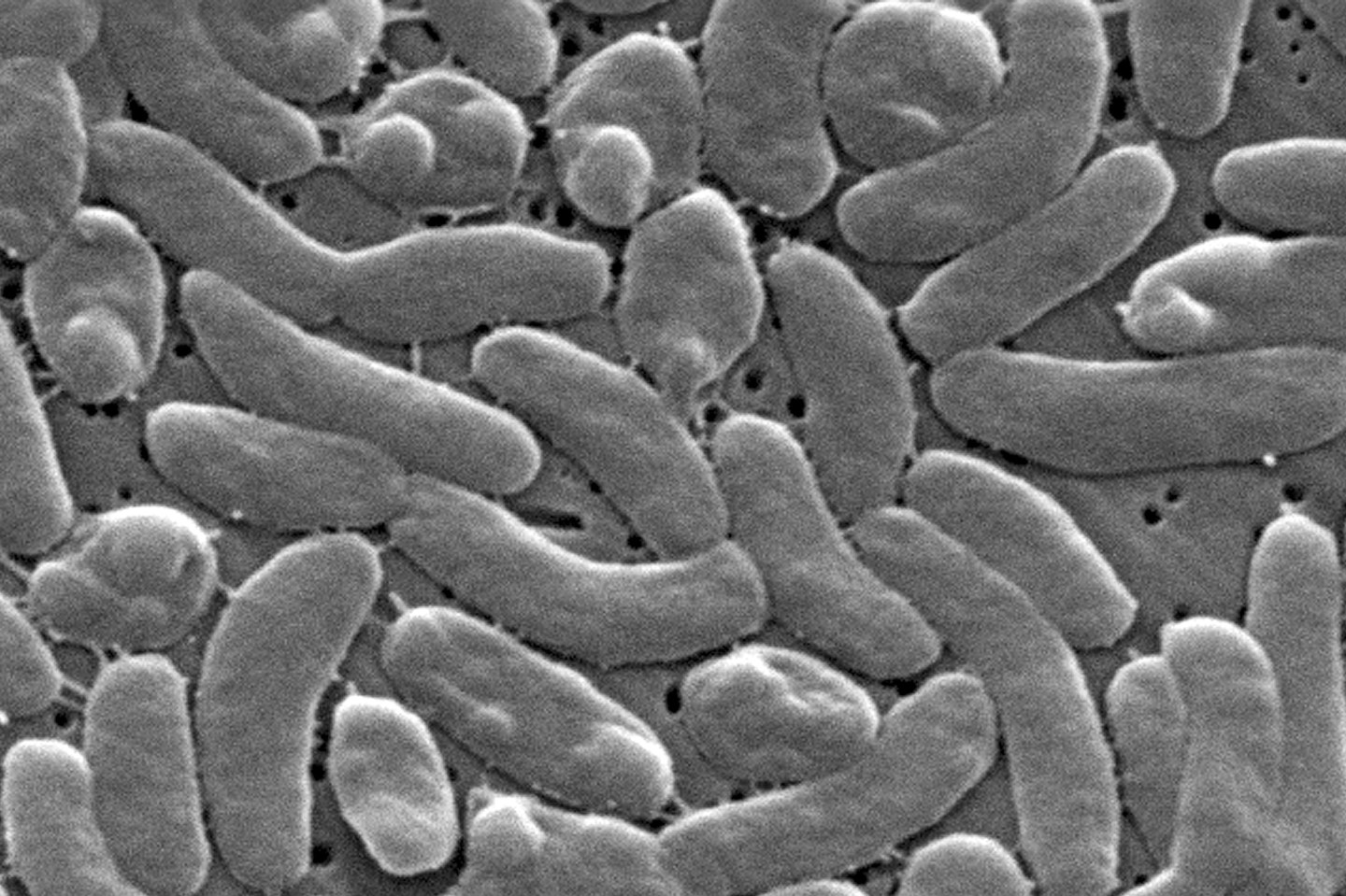 Flesh-eating bacteria infections are surging along the Gulf Coast with five deaths reported in Louisiana