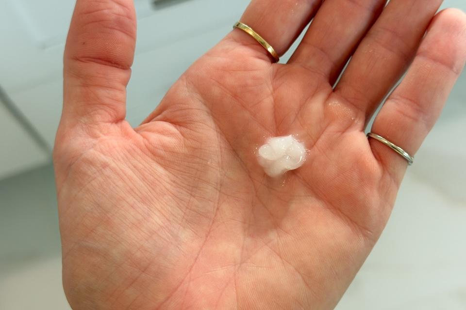 Our tester with the best OTC acne treatment